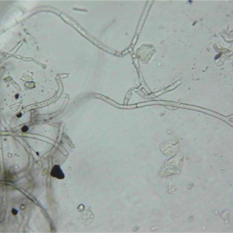Rhizoctonia spp. have hyphae (fungal strands) that show branching at close to right angles, have septa near the branching point and have a constriction near the branching point.