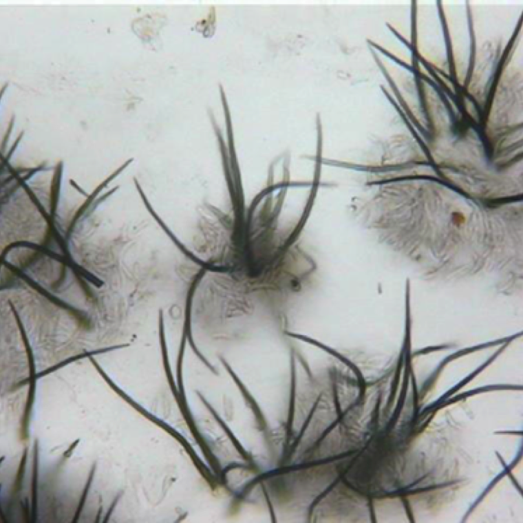 The fungal pathogen has characteristic whisker-like hairs (setae) which is a key identifiable feature. Among the setae, conidia (spores) can also be seen in affected leaves and fruits.