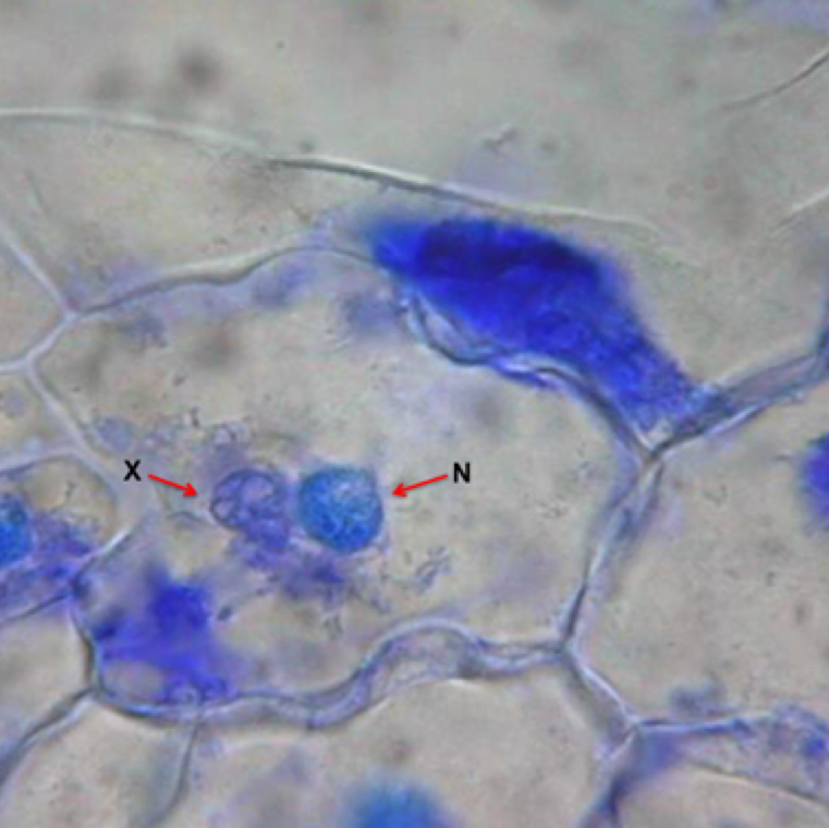 Here we decided to have some fun with staining for confirmation of TMV. Epidermal strips of a tobacco leaf infected with TMV stained in azure A (blue stain) showing  X-bodies (X) and nuclei (N)