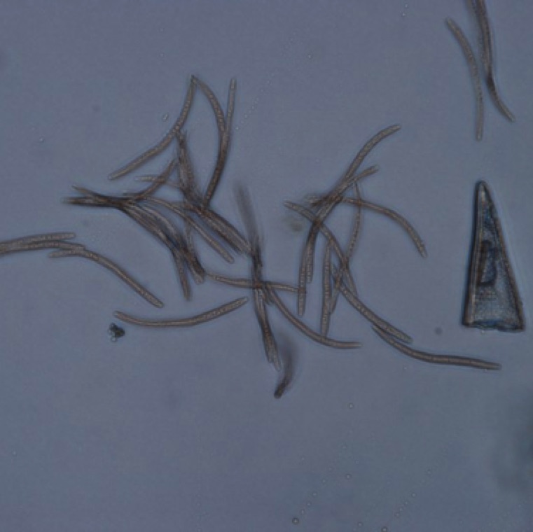 The organism can be identified by the characteristic conidia.