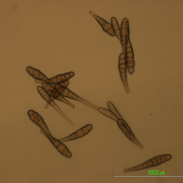 Numerous conidia of Alternaria spp. These are short beak conidia with longitudinal and transverse cross-walls. The spores can easily move in wind and spread the disease.