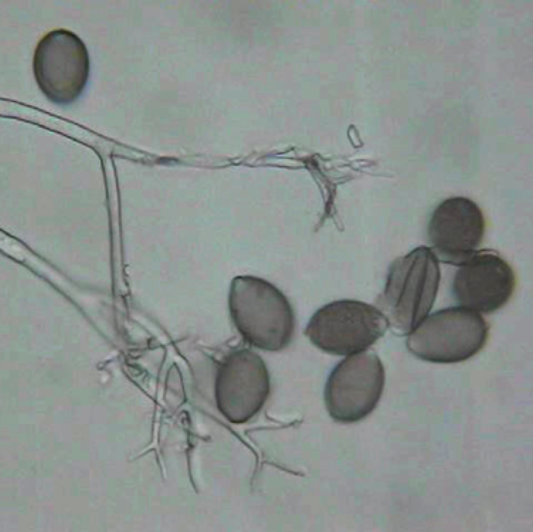 The downy mildew pathogen sporangia are lemon shaped. Sporangiophores emerge from the infected plant stomates in small groups and are dichotomously branched and in clusters.