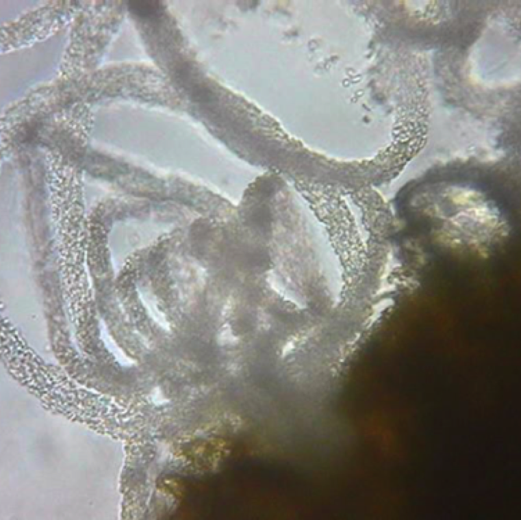 Pycnidia swell and release tendrils of spores if the tissue is wetted in water. This can be easily observed with the use of a microscope. Conidia exuding from pycnidia is in the shape of a "spore horn”
