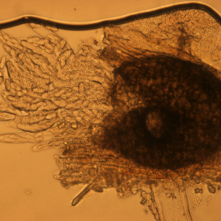 Ascospores inside asci, the flask-shaped structure released from perithecia. The pathogen can survive on seeds, weeds (citron, balsam pear, and other volunteer cucurbits), and plant debris.