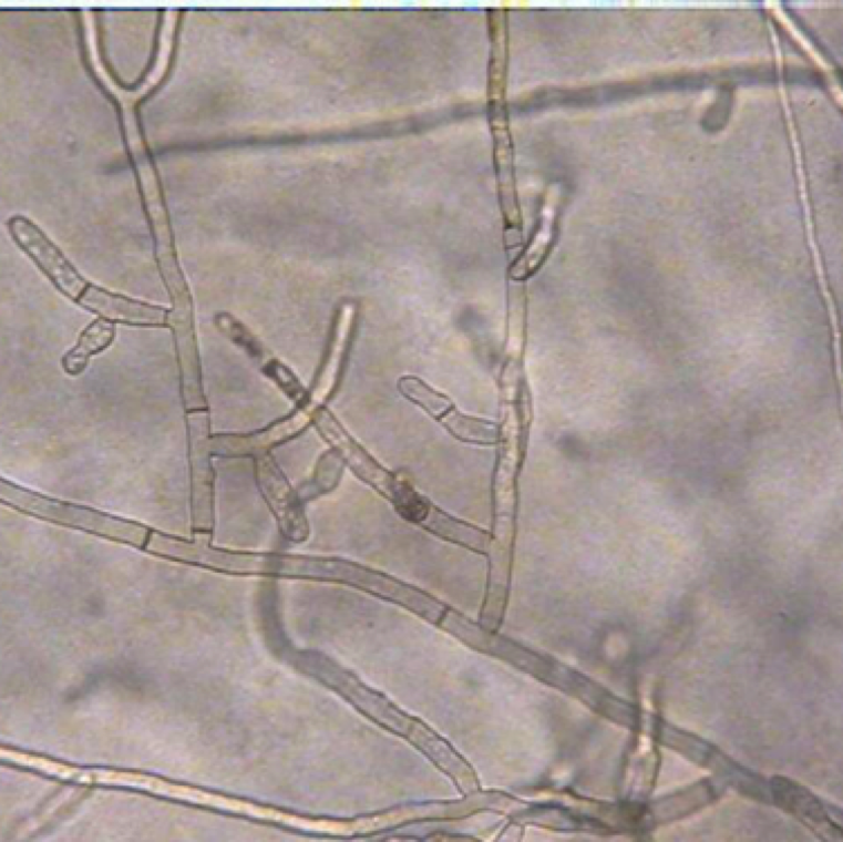 Rhizoctonia spp. have hyphae (fungal strands) that show branching at close to right angles, have septa near the branching point and have a constriction near the branching point.