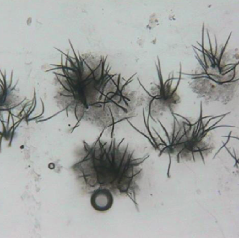 A microscopic picture of Colletotrichum sp. acervuli (asexual fruiting body that are small) from which setae (hair-like or spine-like) growth has formed. Acervuli contains numerous conidia (spores).