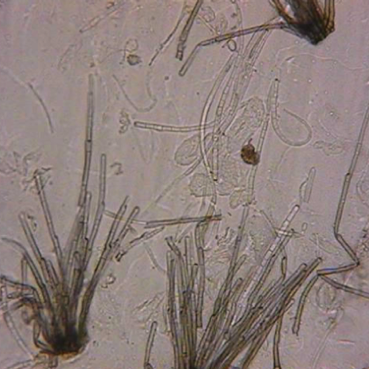Cercospora spp. conidiophores and conidia (spores). The conidia produce hyphae (fungal strands) that penetrate stomates (natural openings on leaves). The spores can be spread by air and water.
