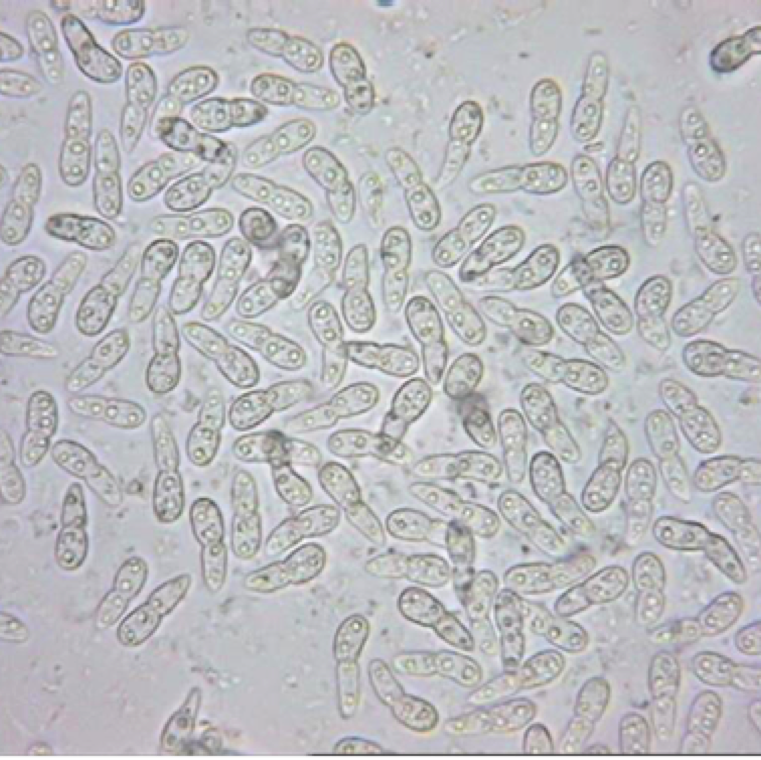 The fungal spores of the pathogen are easily spread by splashing rain or overhead irrigation water. The fungal conidia must be wet for several hours to infect plant tissues.