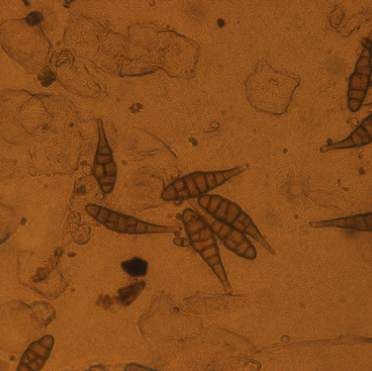 Conidia (spores) of Alternaria alternata f. sp lycopersici. Free water is needed for spore germination and infection process. Spores can thus be spread during heavy rain, continued dew and overhead irrigation.