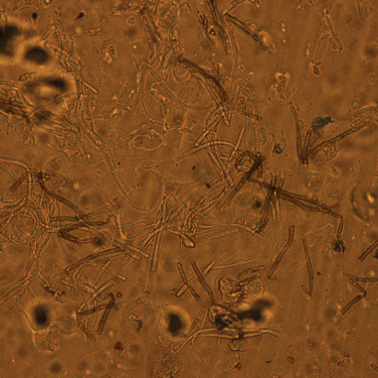 High humidity conditions favor heavy conidia (spore) production usually on the underside of the leaves. The spores can be disseminated by rain splash, water, and equipments.