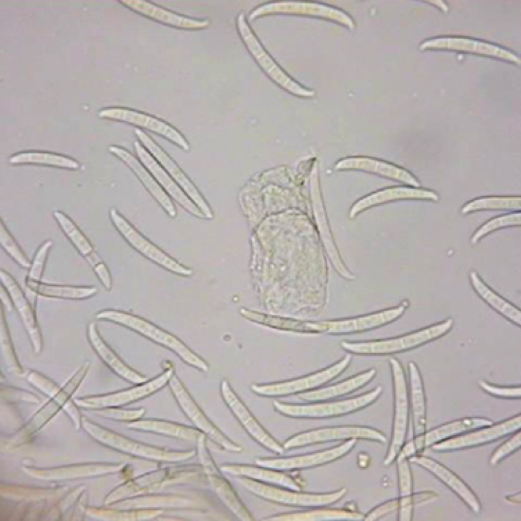Fusarium sp. macrosconidia (spores) are hyaline, multi-septate, curved and pointed at both ends. The pathogen is soil-borne and can survive in soil for many years.