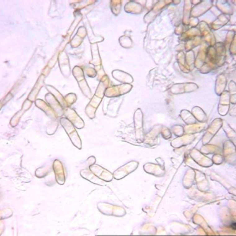 The conidia (spores) of the fungus are carried around through air, water splash, and tools. The fungus can survive on contaminated seeds, plant debris or in soil.