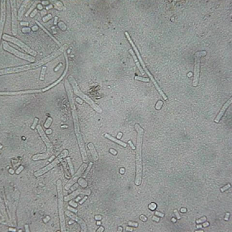 Individual arthroconidia of the fungus Geotrichum candidum. The fungus can survive in soil on plant debris, and on fruit handling equipment, and is an opportunistic pathogen.