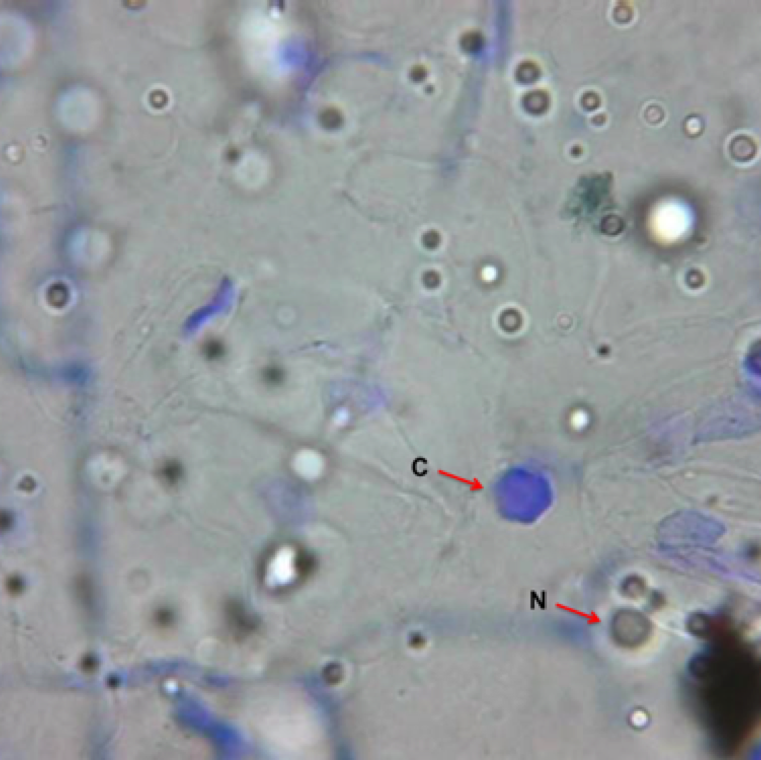 Epidermal strips of a tobacco leaf infected with TMV stained in azure A (blue stain) showing hexagonal crystalline aggregate plates (C) and nuclei (N)