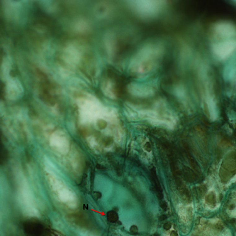 Epidermal strips of a tobacco leaf infected with TMV stained in calcomite orange/ brilliant green showing  showing crystalline aggregate plates (C) and nuclei (N).