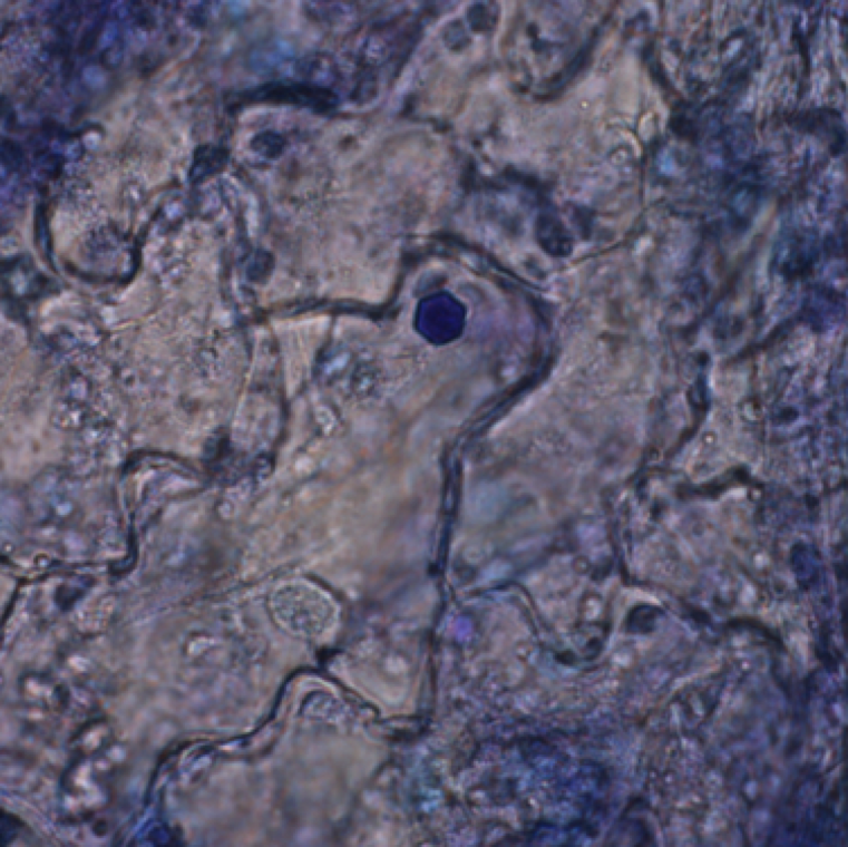 Nuclear inclusion of the virus can be seen as hexagonal shaped structures in plant cell. This is a diagnostic tool but needs molecular assessments of plant samples for pathogen confirmation.